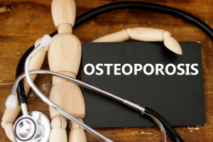 A person's quality of life may be significantly affected by osteoporosis, a condition that makes bones brittle and porous.